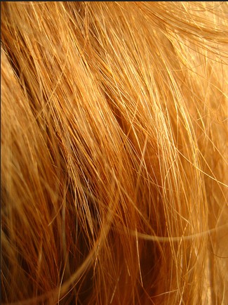 Összefüggést találtak a vörös haj és a bőrrák között