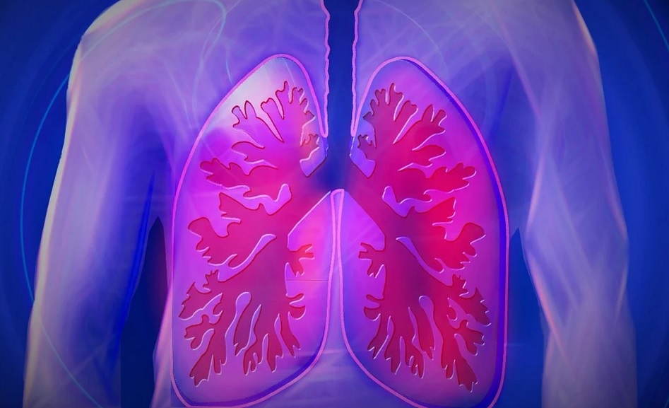 Diagnosztizálták az első új típusú tüdőgyulladást Amerikában