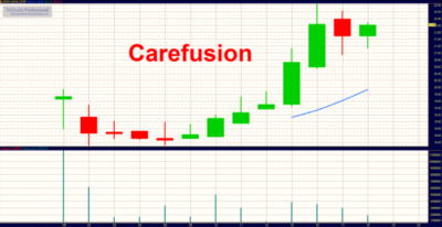 carefusion technikai elemzés