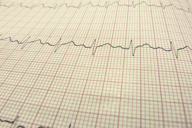 Szeretnéd tudni, hogy még mennyi van hátra az életedből? Megmondjuk!
