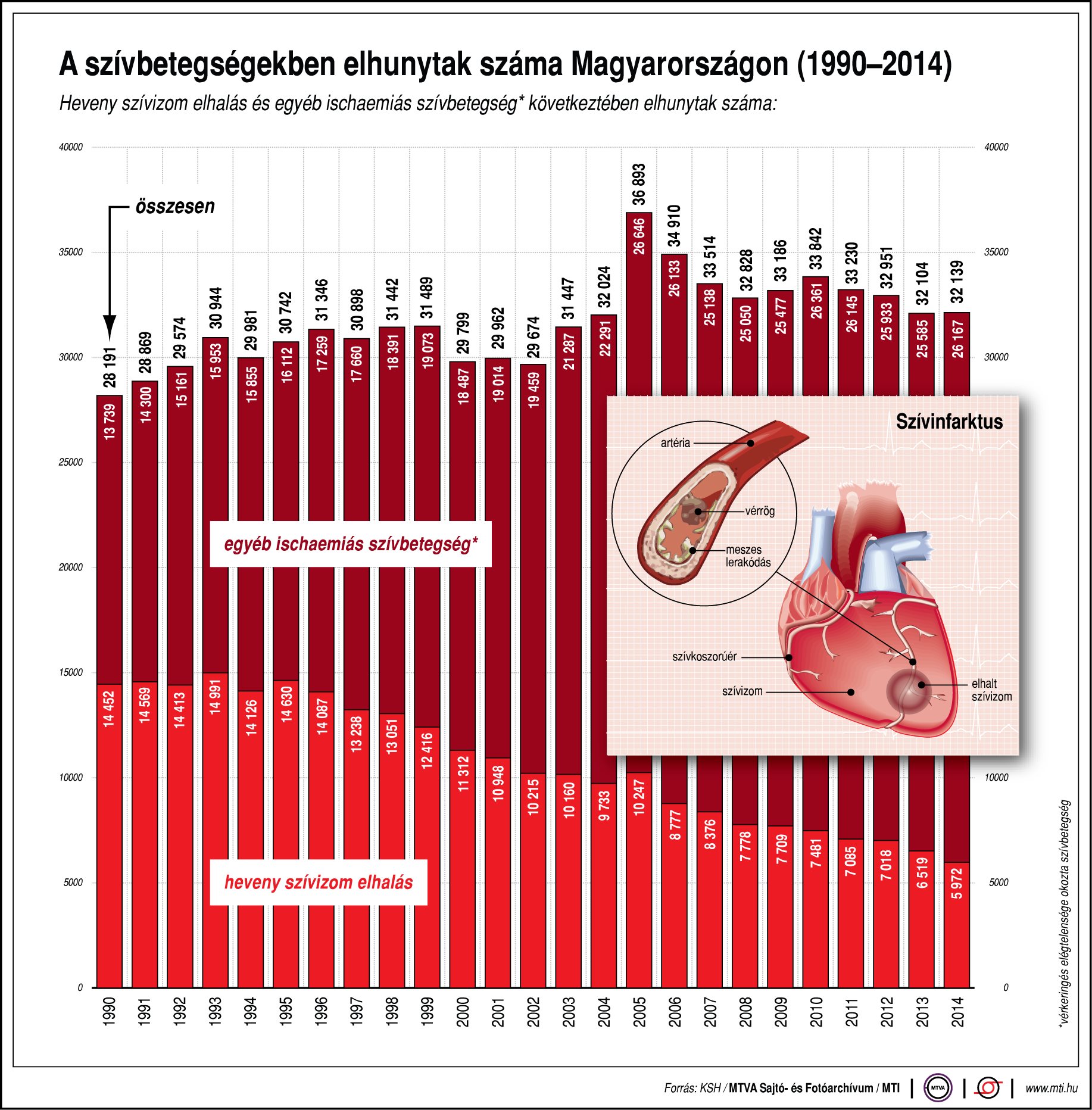 Szívbetegség - ennyi embert visz el évente Magyarországon - ábra