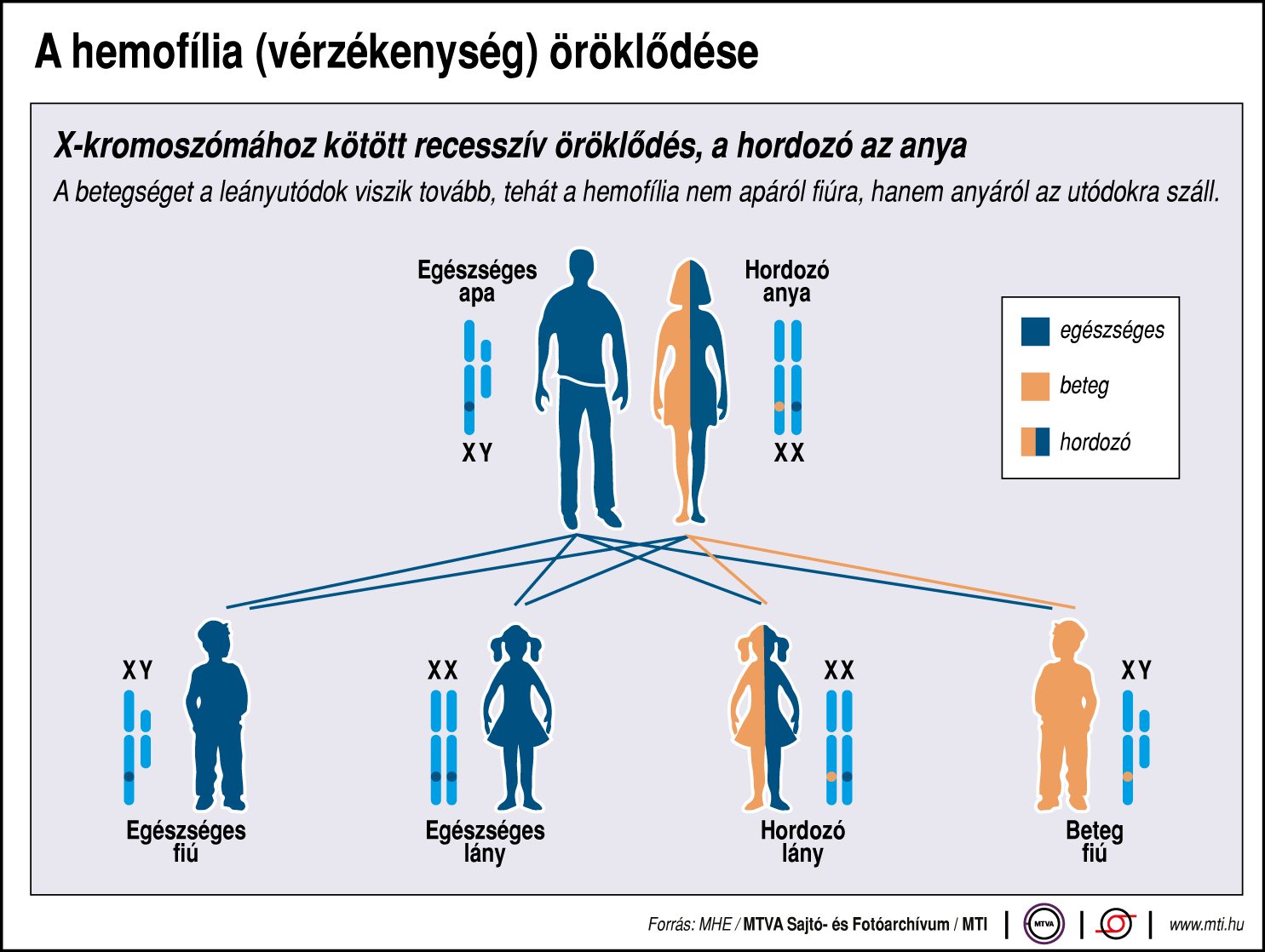 Így öröklődik a vérzékenység - ábrán mutatjuk